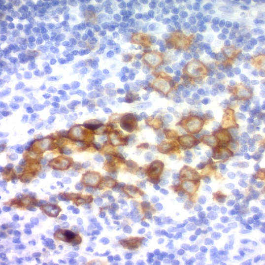 CD30, Ki-1 Antigen; Clone Ber-H2 (Concentrate)